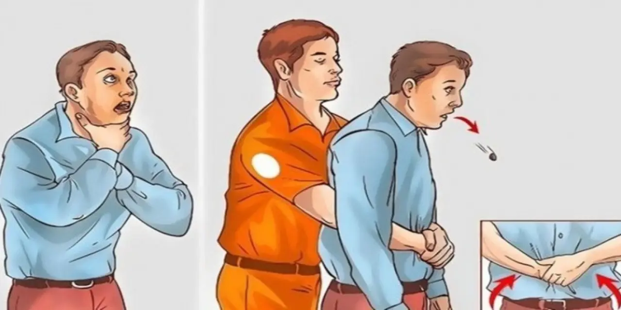 Heimlich Manevrası Nedir, Nasıl Yapılır?