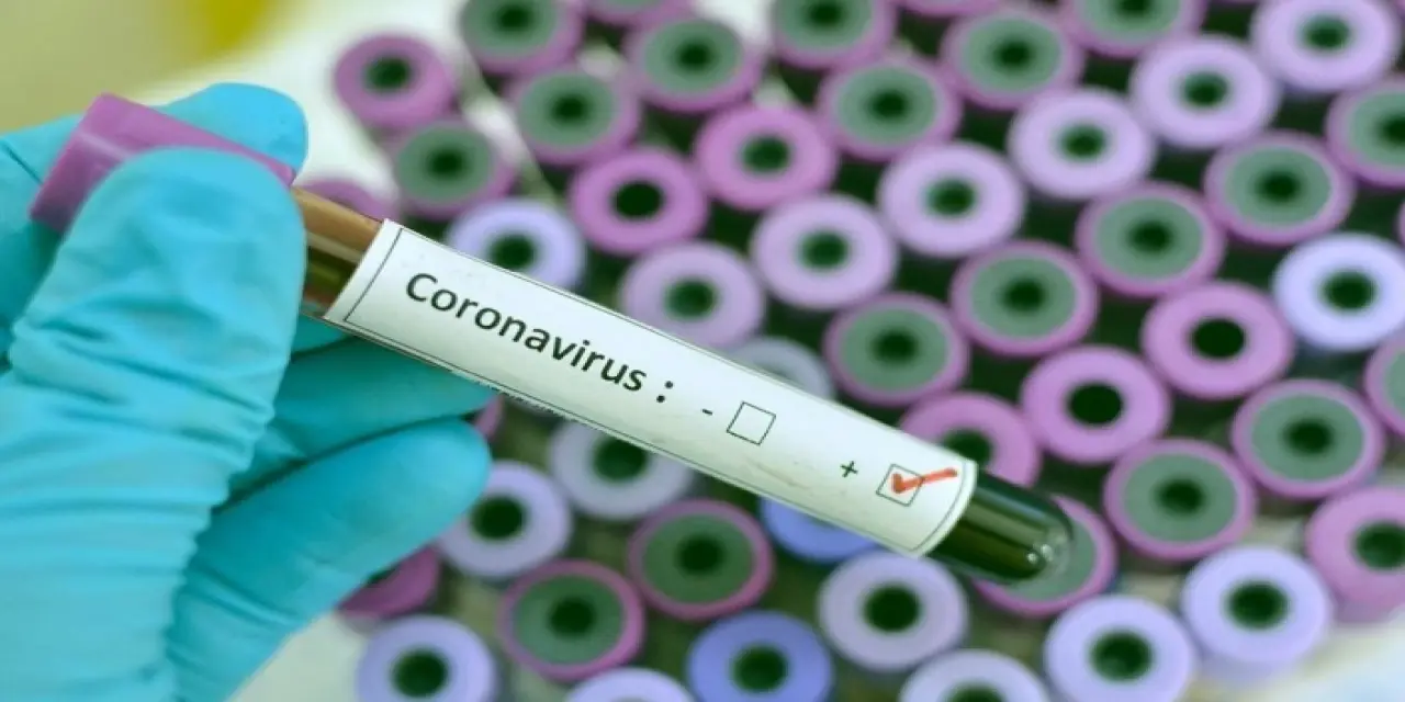 MHRS de e-nabız covid 19 aşısı sorgulaması nasıl yapılır